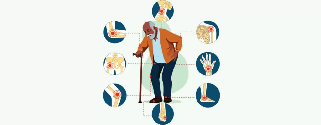 Easing Arthritis Pain with Manual Therapy